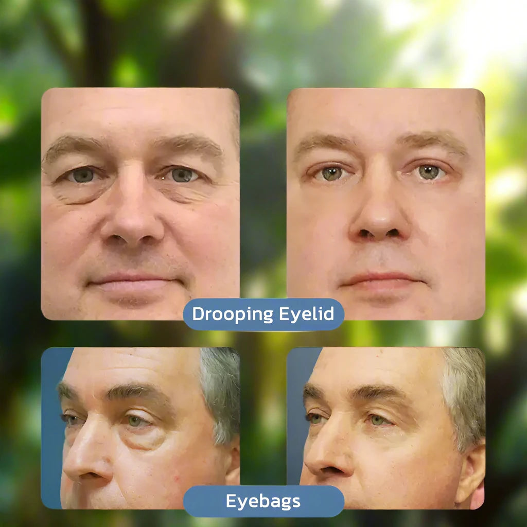 a series of photos showing different stages of eye bags