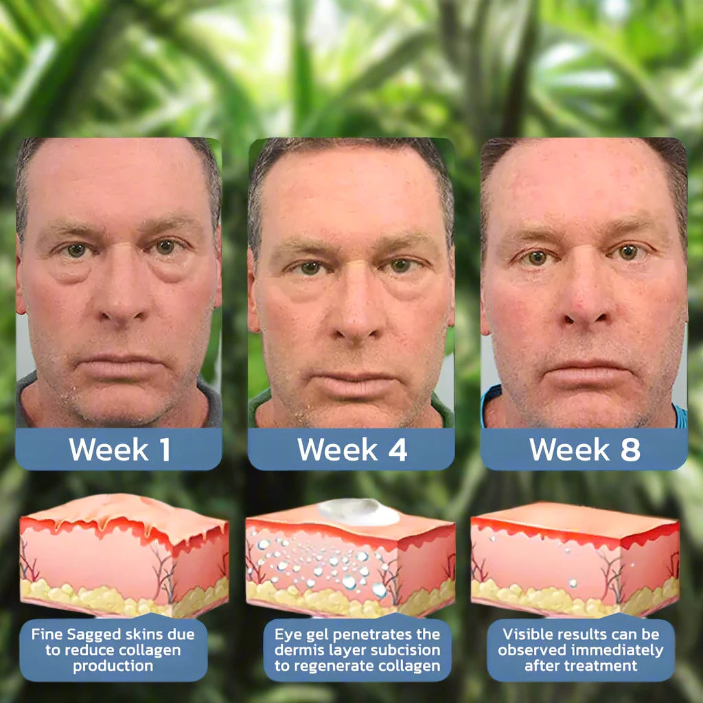 a series of photos showing the stages of a man's facial reconstruction