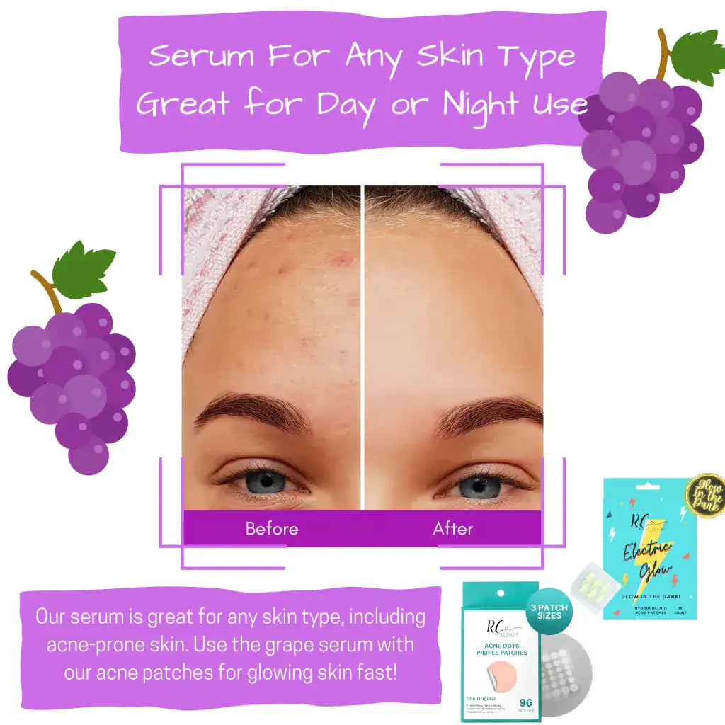 A before-and-after photo showcasing the results of using Rosie Claire Cosmetics Grape Hyaluronic Acid Antioxidant Serum, targeting various skin concerns. This hyaluronic acid serum from Blooming Violets is infused with antioxidant-rich ingredients and vitamin C, ideally suited for skincare enthusiasts, plus it ships free!